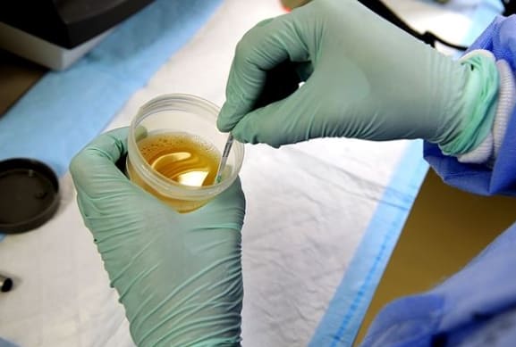 단백뇨 소변검사 PRO 양성일 경우 1 단백뇨 소변검사