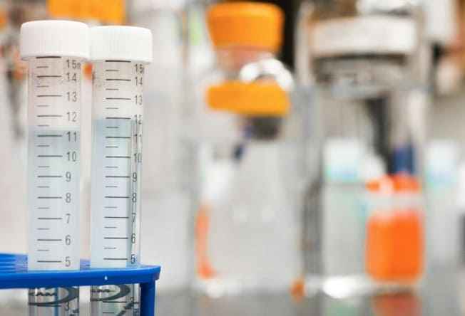 건강검진 소변검사 