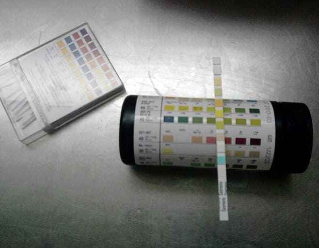 소변 현미경 검사, RBC · WBC · Cast · Crystal · Bacteria 결과지 해석 1 소변 현미경 검사