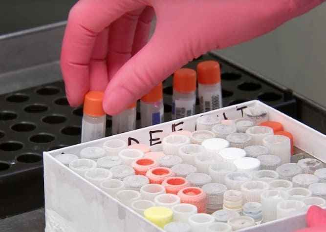 간수치 정상범위 8가지로 알아보는 간기능검사 해석 1 간수치 정상범위