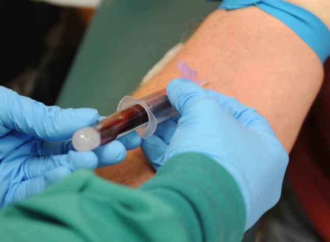 HDL콜레스테롤 높으면 좋기만 할까? 1 HDL콜레스테롤 높으면