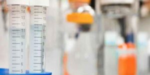 건강검진 소변검사