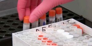 간수치 정상범위