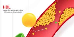 고지혈증 약 효과