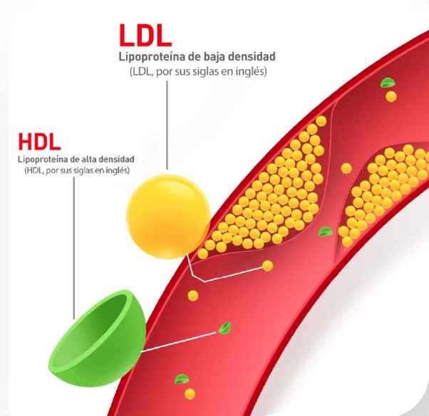 고지혈증 약 효과