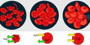 스타틴 약 복용 중단